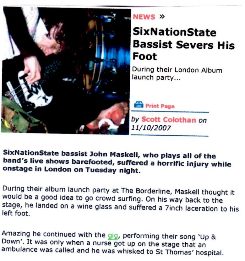 gigwise.com - SixNationState Bassist Severs His Foot